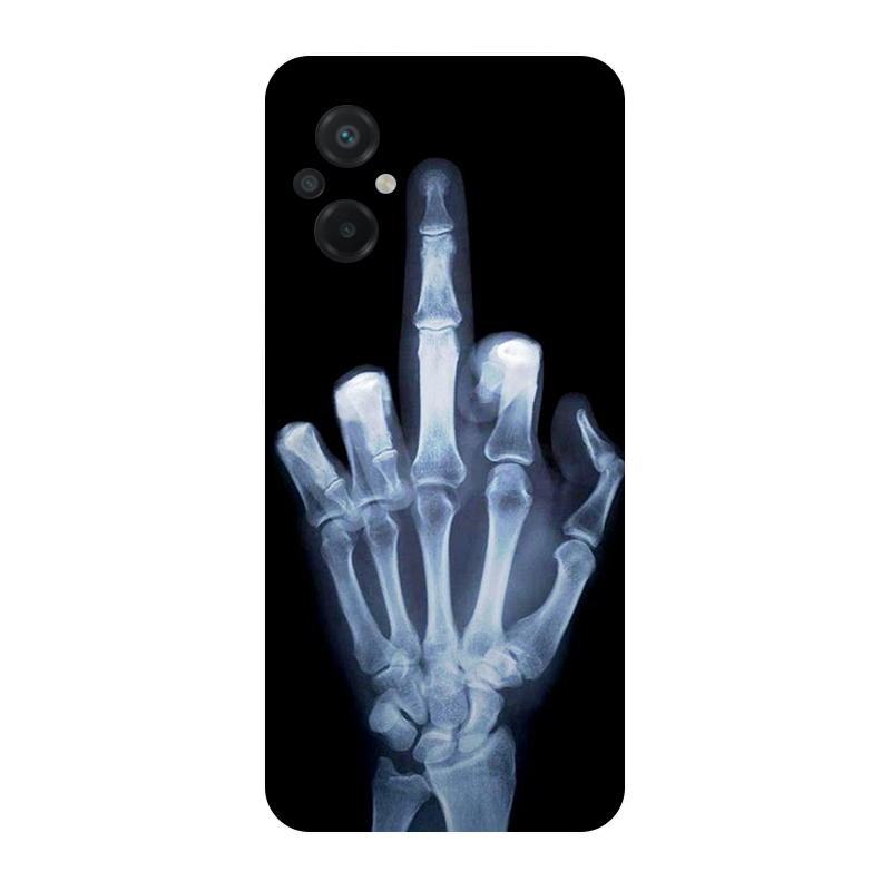 Voor Poco M5 2022 4G Case Voet - Phone Cases Liverpool recensie en prijs
